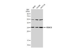 Invitrogen VDAC2 Polyclonal Antibody 100 &mu;L; Unconjugated:Antibodies,