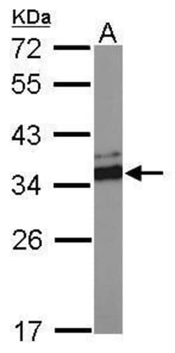 Invitrogen VDAC2 Polyclonal Antibody 100 &mu;L; Unconjugated:Antibodies,