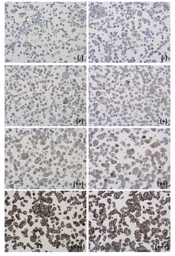 Invitrogen PD-L1 Polyclonal Antibody 100 &mu;L | Buy Online | Invitrogen&trade; | Fisher Scientific