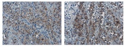 Invitrogen PD-L1 Polyclonal Antibody 100 &mu;L | Buy Online | Invitrogen&trade; | Fisher Scientific