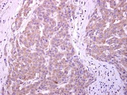 CYP7B1 Polyclonal Antibody, Invitrogen 100 &mu;L | Buy Online | Invitrogen | Fisher Scientific