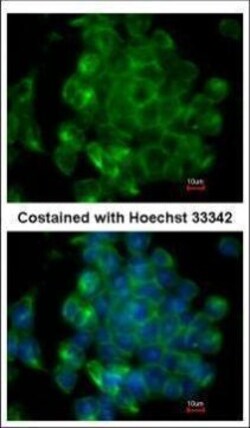 Invitrogen SIPA1 Polyclonal Antibody 100 &mu;L | Buy Online | Invitrogen&trade; | Fisher Scientific