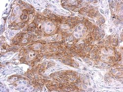 Invitrogen SIPA1 Polyclonal Antibody 100 &mu;L | Buy Online | Invitrogen&trade; | Fisher Scientific