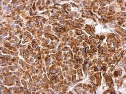Invitrogen SIPA1 Polyclonal Antibody 100 &mu;L | Buy Online | Invitrogen&trade; | Fisher Scientific