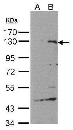 Invitrogen SIPA1 Polyclonal Antibody 100 &mu;L | Buy Online | Invitrogen&trade; | Fisher Scientific