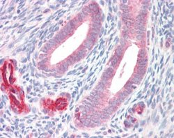 Invitrogen ADAM33 Polyclonal Antibody 100 &mu;L; Unconjugated:Antibodies,