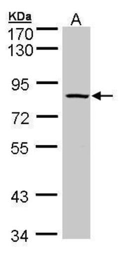 Invitrogen ADAM33 Polyclonal Antibody 100 &mu;L; Unconjugated:Antibodies,