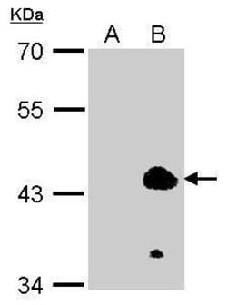 Invitrogen EKLF Polyclonal Antibody 100 &mu;L; Unconjugated:Antibodies,
