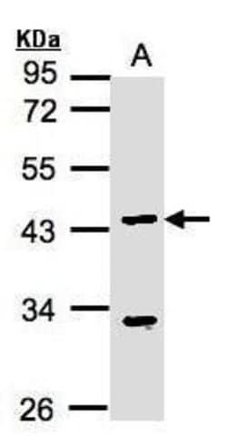 Invitrogen KLF15 Polyclonal Antibody 100 μL; Unconjugated:Antibodies,