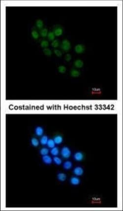 Invitrogen FOXB1 Polyclonal Antibody 100 &mu;L | Buy Online | Invitrogen&trade; | Fisher Scientific