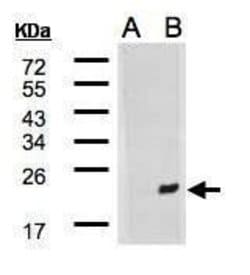 Invitrogen DNAJB9 Polyclonal Antibody 100 &mu;L; Unconjugated:Antibodies,
