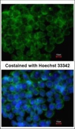 Invitrogen IRF6 Polyclonal Antibody 100 &mu;L | Buy Online | Invitrogen&trade; | Fisher Scientific