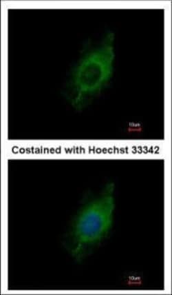 Invitrogen Kinesin 5A Polyclonal Antibody 100 &mu;L; Unconjugated:Antibodies,