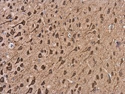 Invitrogen Kinesin 5A Polyclonal Antibody 100 &mu;L; Unconjugated:Antibodies,
