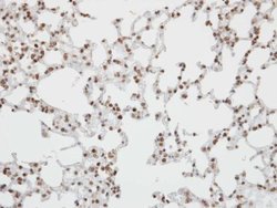 Invitrogen Pokemon Polyclonal Antibody 100 &mu;L; Unconjugated:Antibodies,