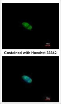 Invitrogen ZNF148 Polyclonal Antibody 100 &mu;L | Buy Online | Invitrogen&trade; | Fisher Scientific