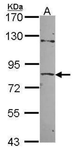 Invitrogen ZNF148 Polyclonal Antibody 100 &mu;L | Buy Online | Invitrogen&trade; | Fisher Scientific