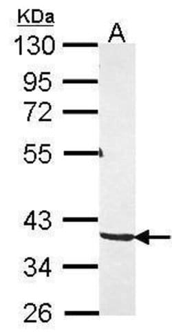Invitrogen PKA gamma Polyclonal Antibody 100 &mu;L; Unconjugated:Antibodies,