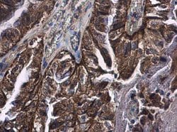 FCAR Polyclonal Antibody:Antibodies, Polyclonal