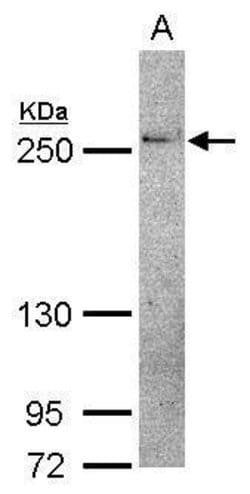 Invitrogen THADA Polyclonal Antibody 100 μL; Unconjugated:Antibodies,