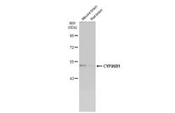 Invitrogen CYP26B1 Polyclonal Antibody 100 &mu;L; Unconjugated:Antibodies,
