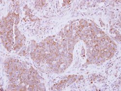 Invitrogen ADAM10 Polyclonal Antibody 100 μL; Unconjugated:Antibodies,
