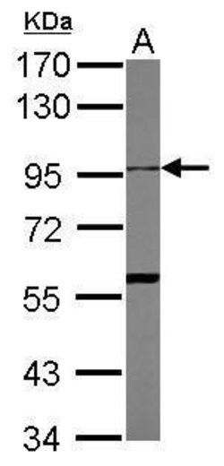 Invitrogen ADAM10 Polyclonal Antibody 100 μL; Unconjugated:Antibodies,