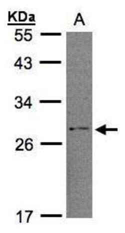 RGS2 Polyclonal Antibody, Invitrogen 100 &mu;L | Buy Online | Thermo Scientific | Fisher Scientific