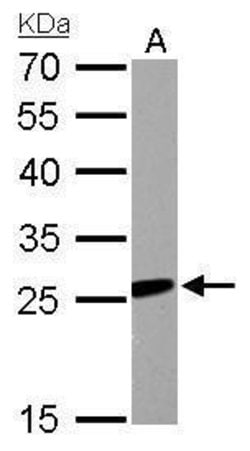 RGS2 Polyclonal Antibody, Invitrogen 100 &mu;L | Buy Online | Thermo Scientific | Fisher Scientific