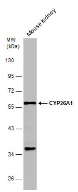 Invitrogen CYP26A1 Polyclonal Antibody 100 &mu;L; Unconjugated:Antibodies,