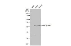 Invitrogen CYP26A1 Polyclonal Antibody 100 &mu;L; Unconjugated:Antibodies,