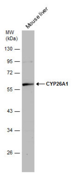 Invitrogen CYP26A1 Polyclonal Antibody 100 &mu;L; Unconjugated:Antibodies,