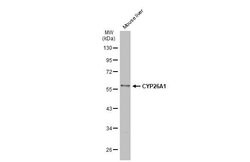 Invitrogen CYP26A1 Polyclonal Antibody 100 &mu;L; Unconjugated:Antibodies,