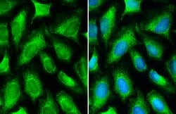 Invitrogen MTHFD2 Polyclonal Antibody 100 &mu;L; Unconjugated:Antibodies,