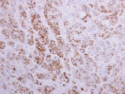 Invitrogen MTHFD2 Polyclonal Antibody 100 &mu;L; Unconjugated:Antibodies,