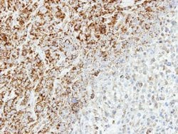 Invitrogen MTHFD2 Polyclonal Antibody 100 &mu;L; Unconjugated:Antibodies,