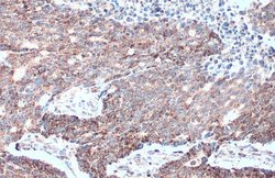 Invitrogen MTHFD2 Polyclonal Antibody 100 &mu;L; Unconjugated:Antibodies,