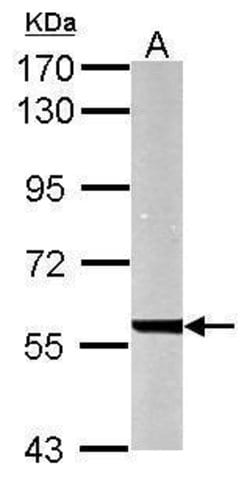Invitrogen UGDH Polyclonal Antibody 100 μL; Unconjugated:Antibodies,