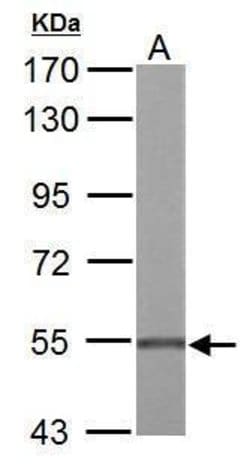 Invitrogen UGDH Polyclonal Antibody 100 μL; Unconjugated:Antibodies,
