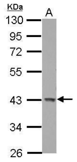 Invitrogen GALK1 Polyclonal Antibody 100 &mu;L | Buy Online | Invitrogen&trade; | Fisher Scientific
