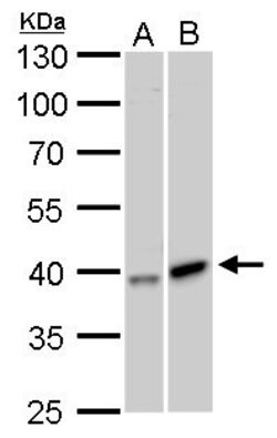 Invitrogen GALK1 Polyclonal Antibody 100 &mu;L | Buy Online | Invitrogen&trade; | Fisher Scientific