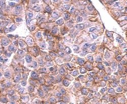 Invitrogen SLC20A1 Polyclonal Antibody 100 &mu;L; Unconjugated:Antibodies,