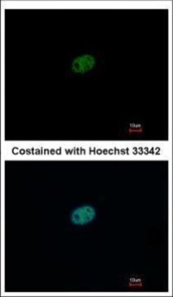 Invitrogen RFC2 Polyclonal Antibody 100 &mu;L | Buy Online | Invitrogen&trade; | Fisher Scientific