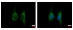 Invitrogen KIR2DL4 Polyclonal Antibody 100 &mu;L; Unconjugated:Antibodies,