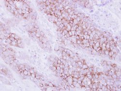 Invitrogen KIR2DL4 Polyclonal Antibody 100 &mu;L; Unconjugated:Antibodies,