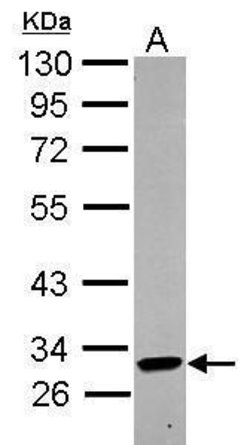 Invitrogen KIR2DL4 Polyclonal Antibody 100 &mu;L; Unconjugated:Antibodies,