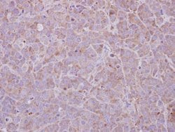Invitrogen MAGEB1 Polyclonal Antibody 100 &mu;L; Unconjugated:Antibodies,