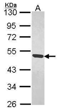 Invitrogen MAGEB1 Polyclonal Antibody 100 &mu;L; Unconjugated:Antibodies,