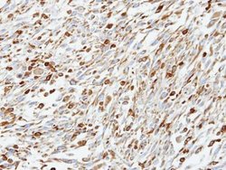 Invitrogen CALCOCO1 Polyclonal Antibody 100 &mu;L | Buy Online | Invitrogen&trade; | Fisher Scientific