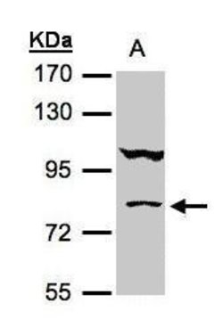 Invitrogen CALCOCO1 Polyclonal Antibody 100 &mu;L | Buy Online | Invitrogen&trade; | Fisher Scientific